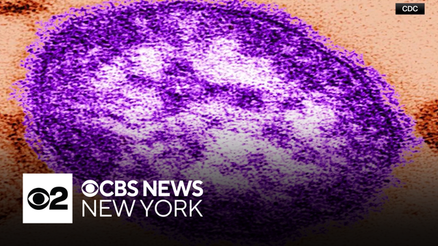 New York Gov. Hochul declares state disaster emergency over measles outbreak
