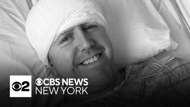 How DBS helped treat a CBS News New York sports producer's Parkinson's disease