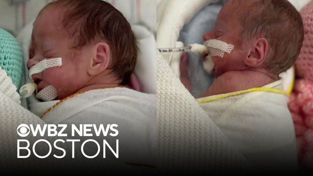 Twin babies separated in NICUs at 2 Boston hospitals. Parents plead for transfer.