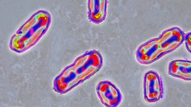 Medical experts on plague risks
