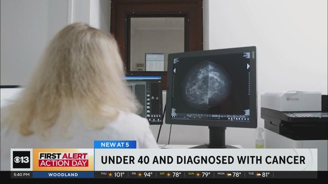 UC Davis offering free mammograms as breast cancer cases rise