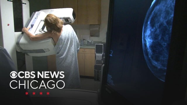 Endeavor Health joins Chicago Breast Cancer Research Consortium