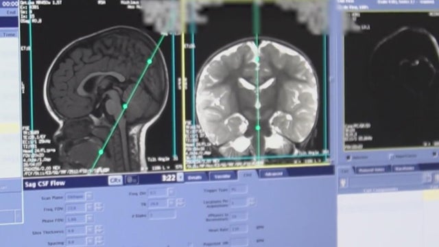October is ADHD awareness: What experts are saying about diagnosis in women