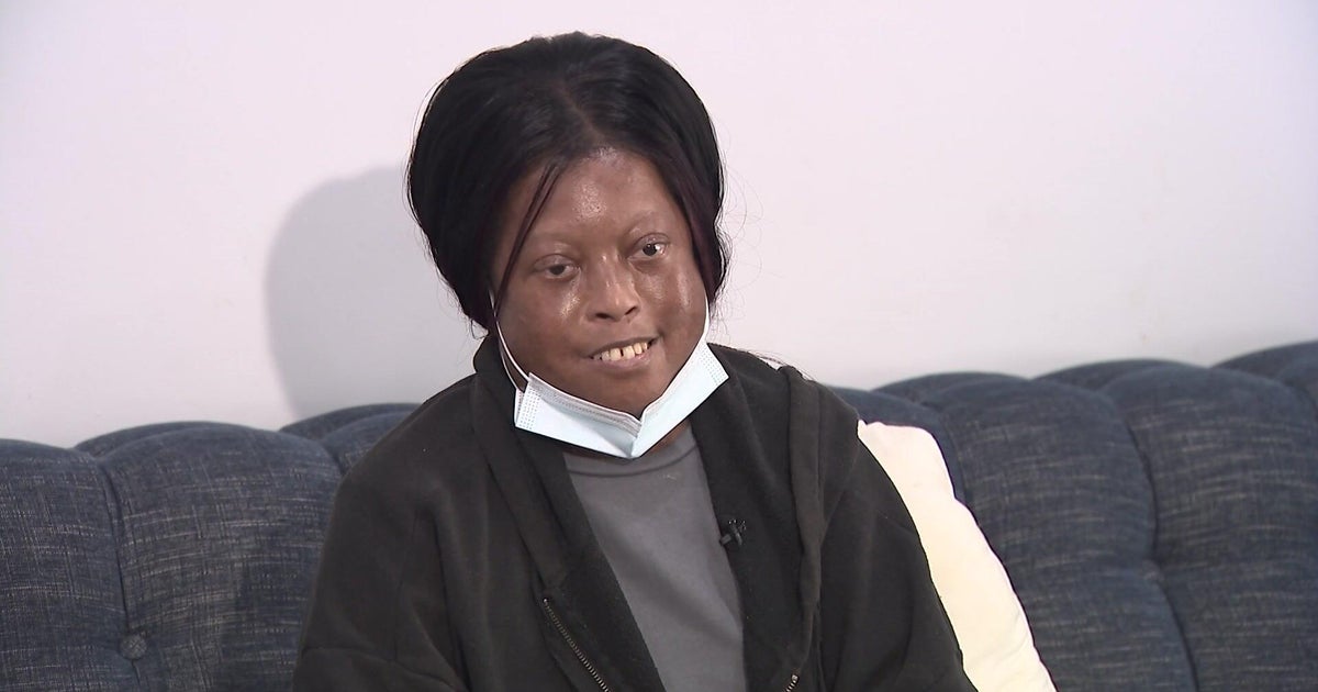 Life-saving lung transplant gives Long Island mom second chance at life