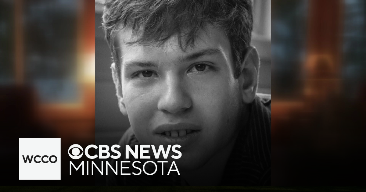 Minnesota man dies after routine dental cleaning in Hopkins, police ...
