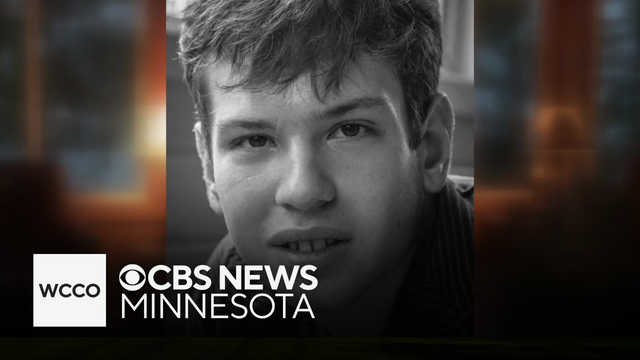 Minnesota man dies after routine dental cleaning in Hopkins, police investigating