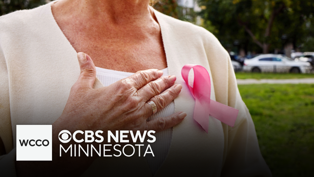 Minnesota Oncology partners with virtual clinic for breast cancer risk assessment