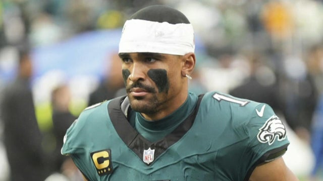 Jalen Hurts' diagnosis rattles sports world