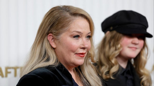 Christina Applegate reveals MS misdiagnoses