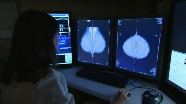 for-web-mammogram.jpg 