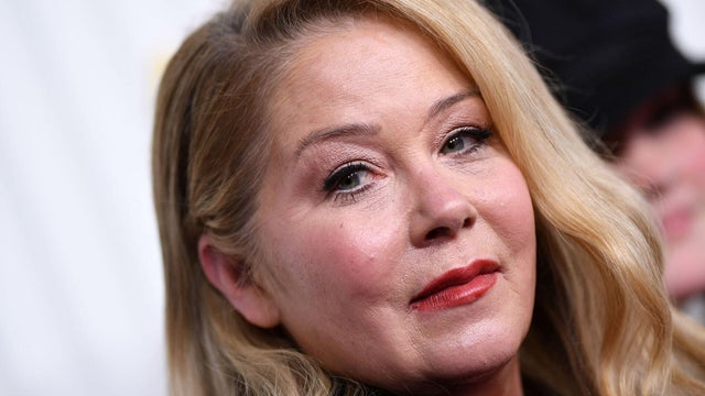 Doctor on Christina Applegate's misdiagnosis