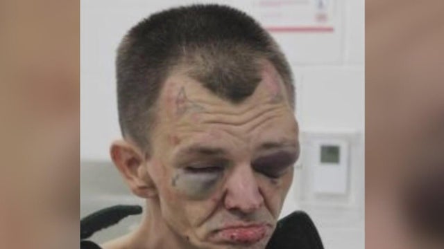 Fayette County DA weighs charges against corrections officers after alleged jail beating