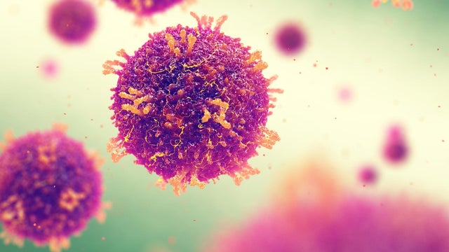 Measles Morbilliviruses 