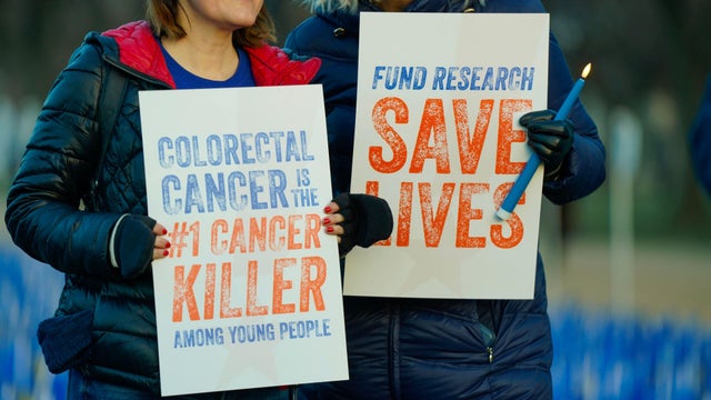 Colorectal Cancer 