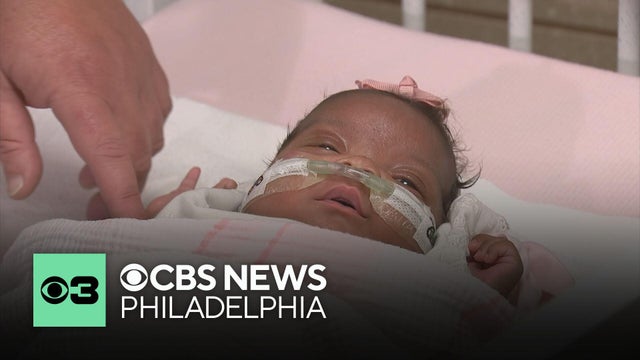How a tiny baby in Pennsylvania is overcoming the odds and sparking new friendships